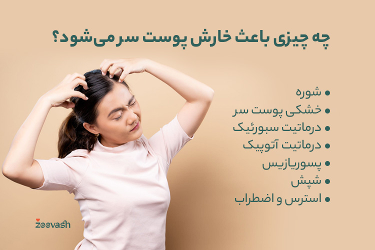چه چیزی باعث خارش پوست سر می‌شود؟
